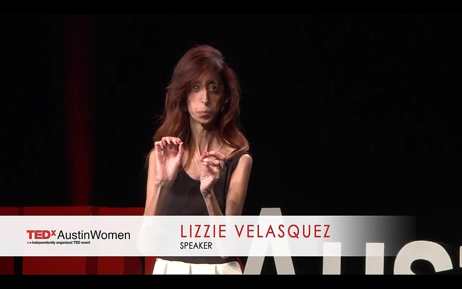 Lizzie Velasquez Bikini